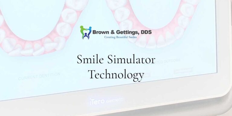 monthlys – blog – smile simulator technology – dec – brown – 1200 x 630