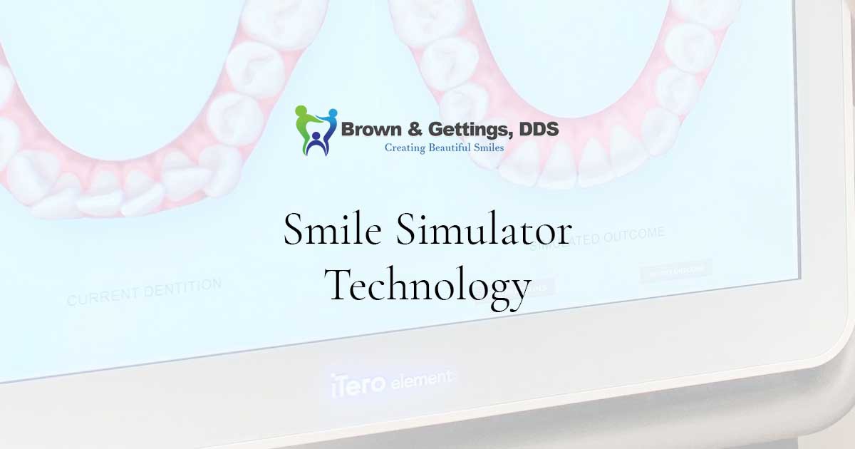 monthlys – blog – smile simulator technology – dec – brown – 1200 x 630