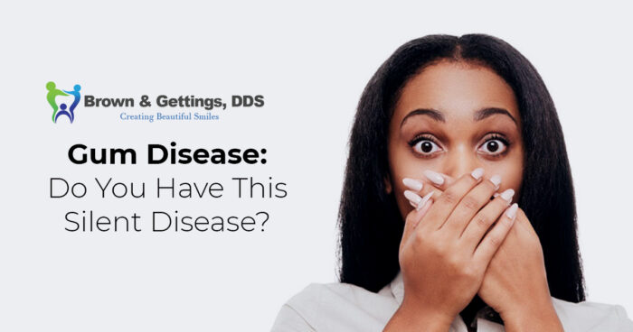 Brown – Blog – Gum Disease Do you have this silent disease – 1200×630 – V1 copy