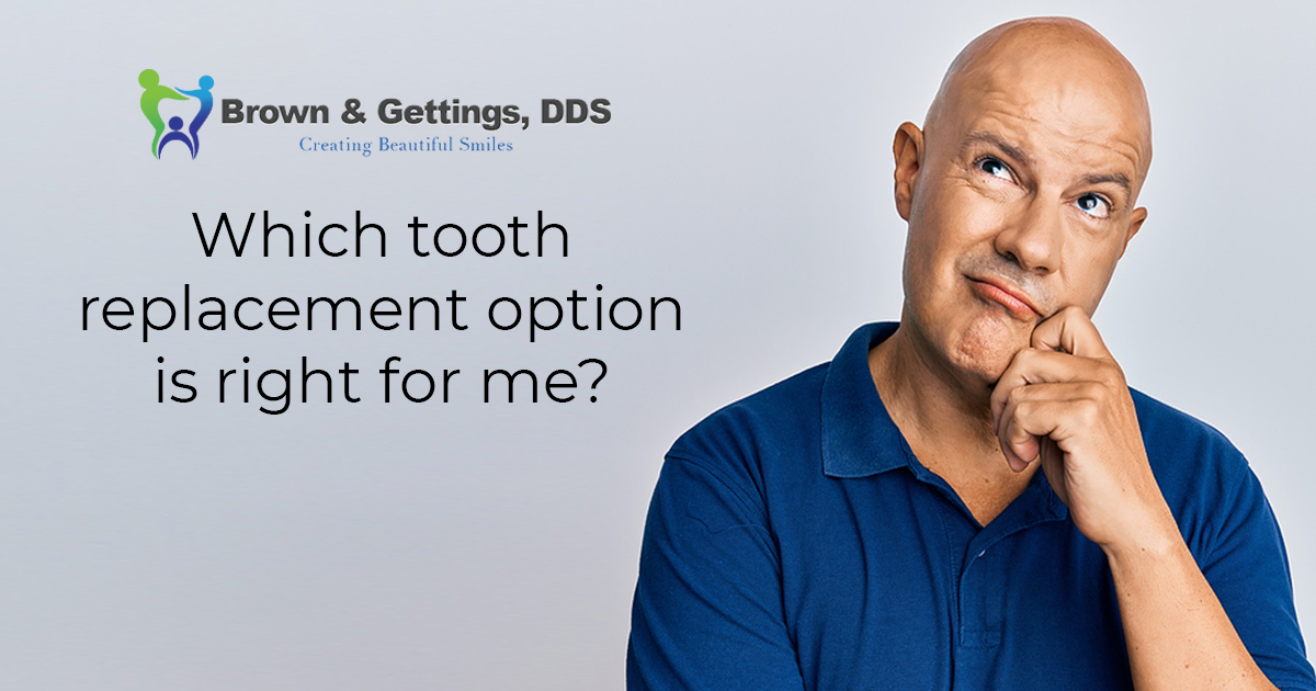 Brown – email -june- 1200×630 – V1 which tooth replacement option is right for me?