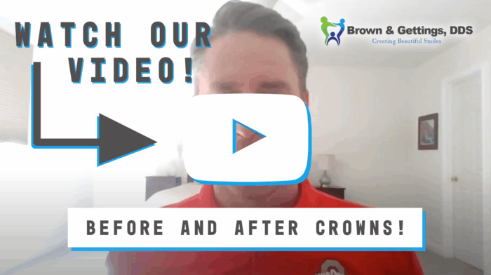 Brown_Blog_1200x630 (1) before and after video