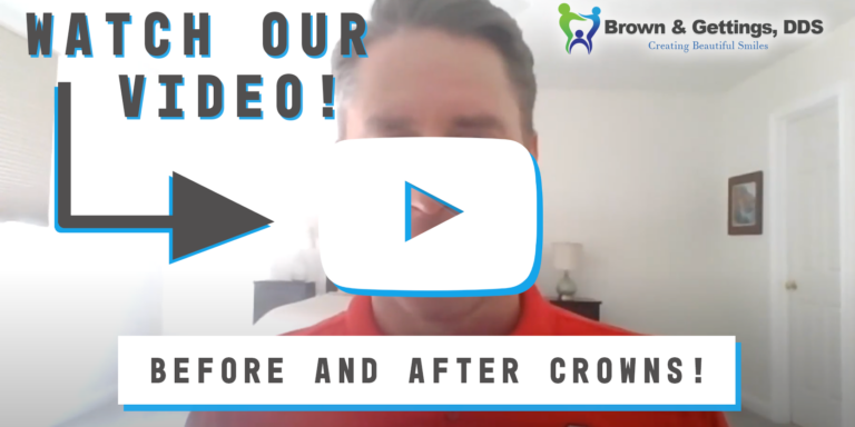 Brown_Blog_1200x630 (1) before and after video