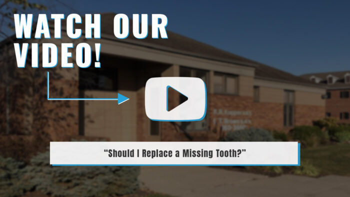 replace a missing tooth video