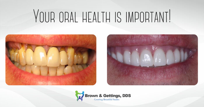 before and after images