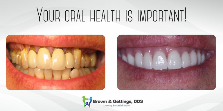 Brown_Blog_1200x630 (2) before and after images