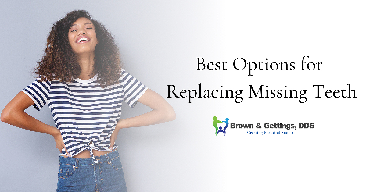 Brown_Blog_1200x630 best options for missing teeth