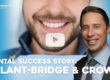 implant bridges and crowns video