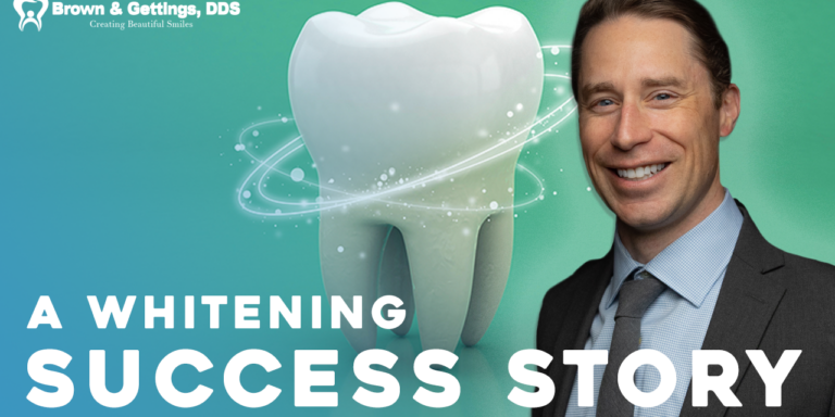 Brown_YT_Thumbnail_Whitening_V2 whitening video