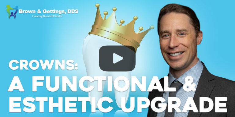 Dr-Brown-Speaks-the-Tooth-Crowns-web-image-1200×630-v1 crowns, a functional and esthetic upgrade video