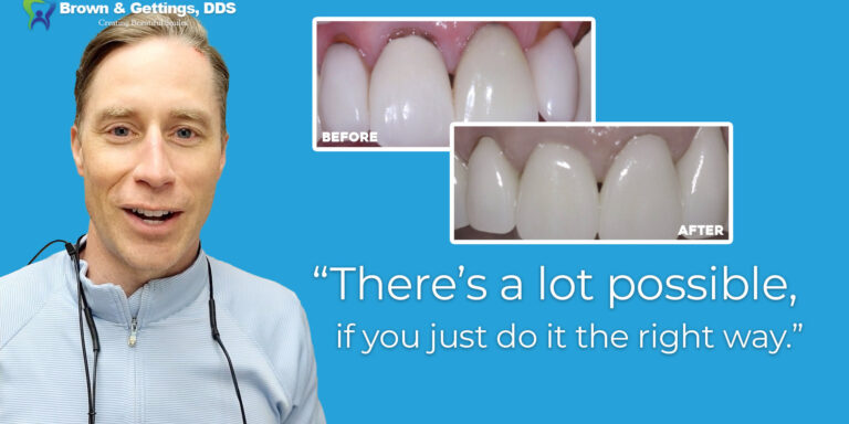 BrownGettings-Scaling_Crowns-1920×1080-v1