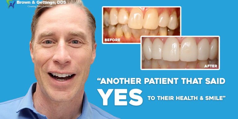 BrownGettings-Veneers-Before_After-Video-1920×1080