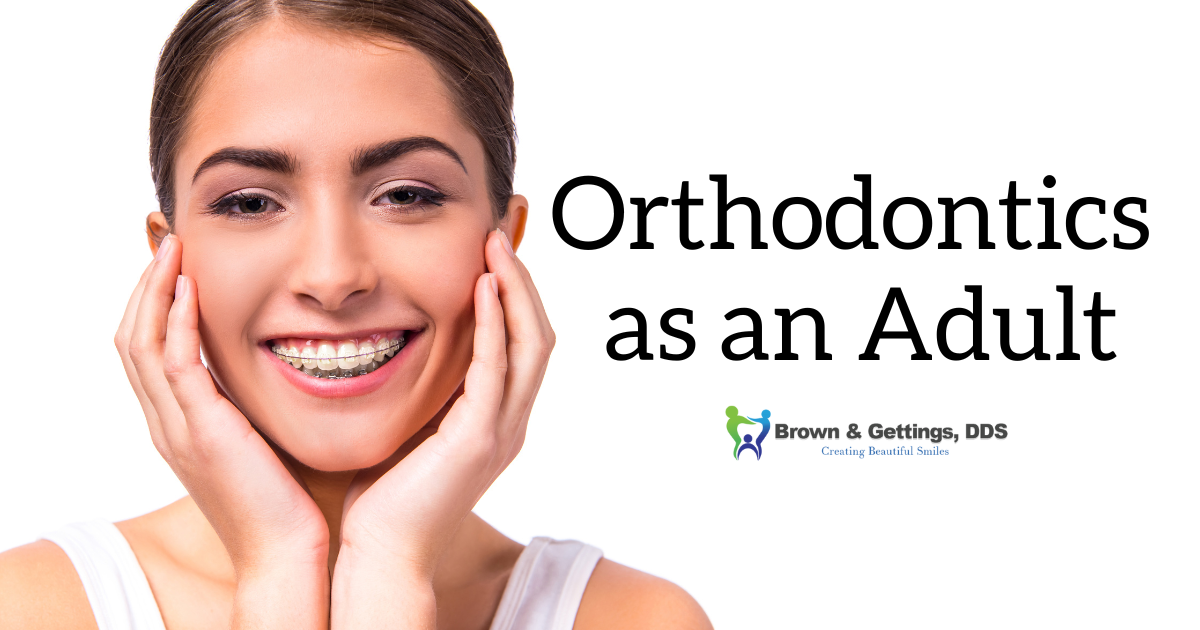 Orthodontics As An Adult – Drs. Brown, Gettings & Gade - West Chester ...