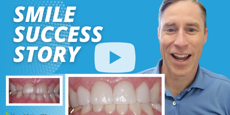 Brown_Smile Success Story_Thumbnail