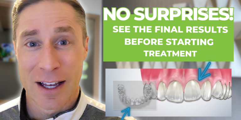 Brown_Clear Aligners Custom Thumbnail