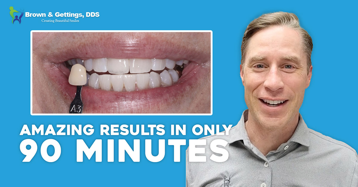 Zoom! Whitening Before & After 3 Drs. Brown, Gettings & Gade West