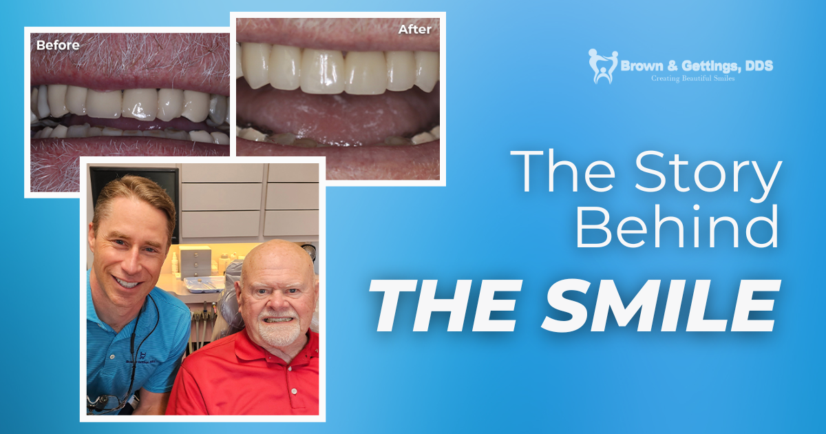 Smile Success Story - Brown & Gettings, DDS