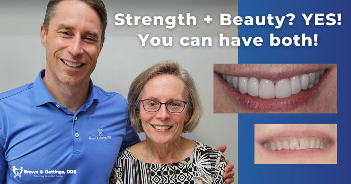 Restore And Improve Your Teeth And Smile