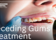 How to Fix Receding Gums