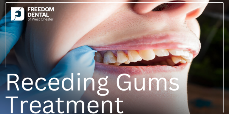How to Fix Receding Gums How to Fix Receding Gums