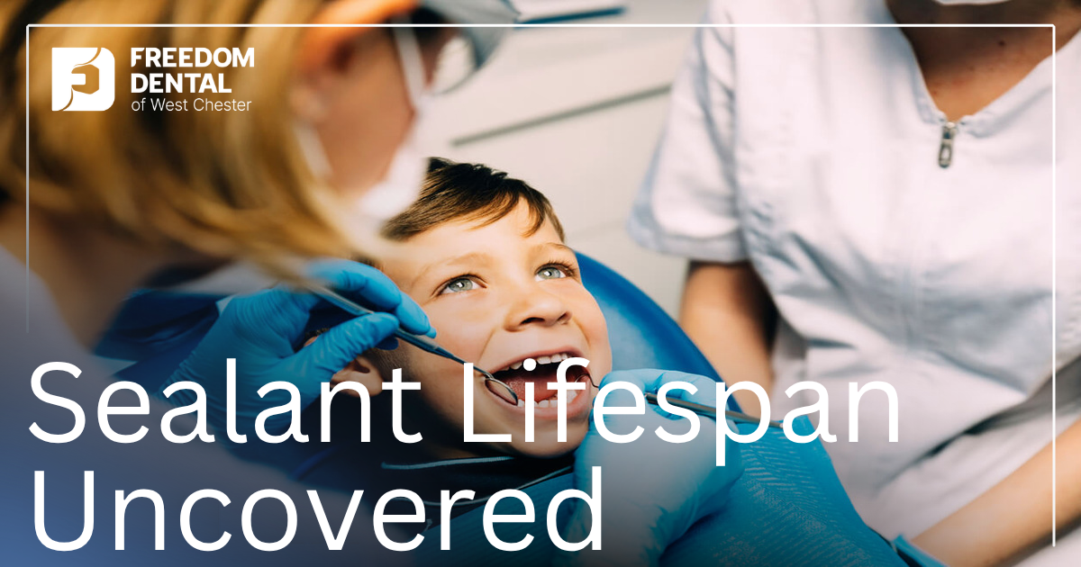 How Long Do Dental Sealants Last