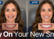a side. by side before and after of a woman smiling after her new teeth